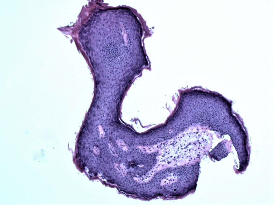 Featured PathArt microscopy image