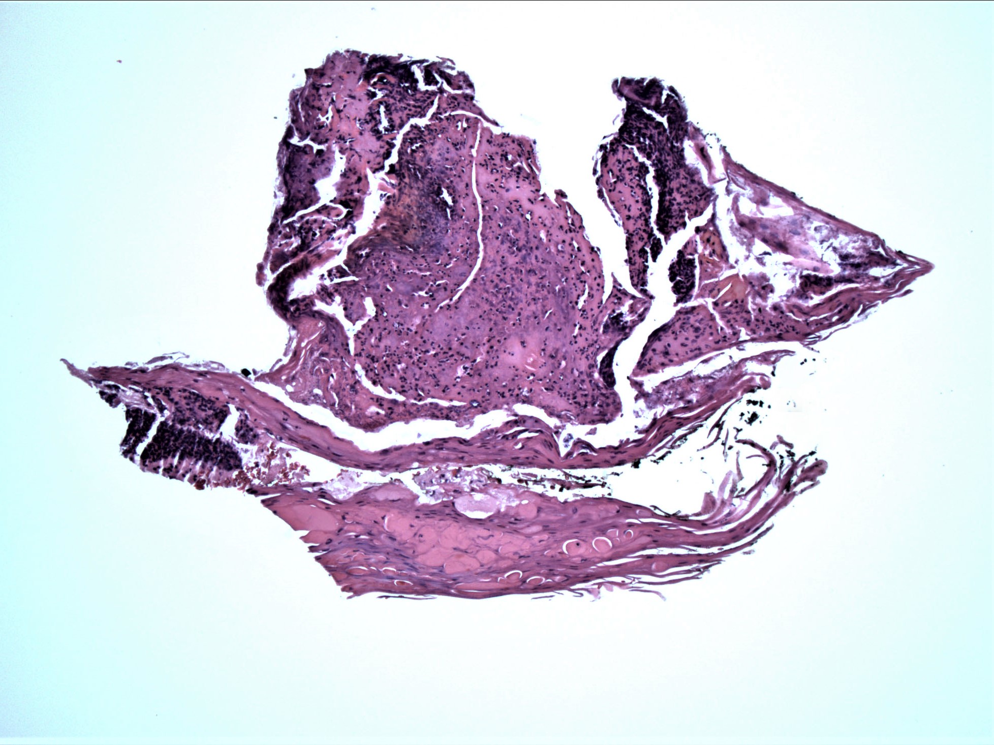 PathArt gallery image