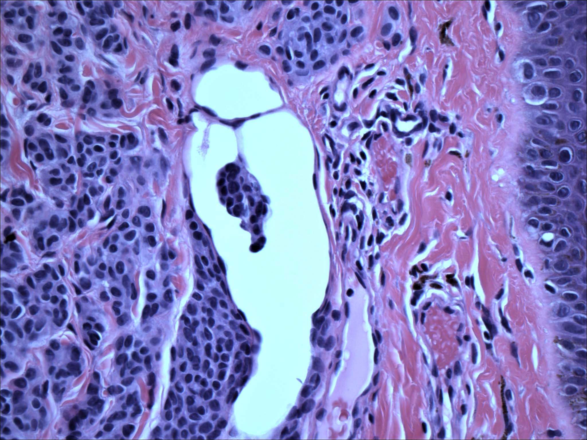 PathArt gallery image